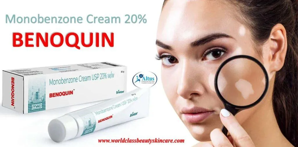 Benoqin Cream 1024x504 1
