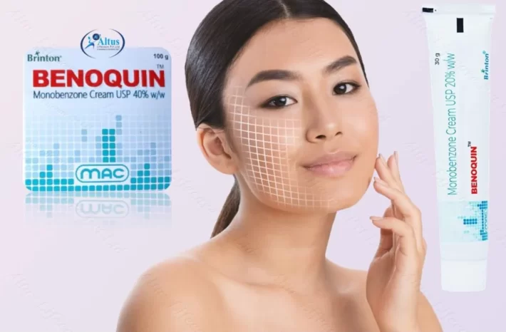 Vitiligo Treatment: Witness the Unthinkable: Benoquin Cream's Jaw-Dropping!