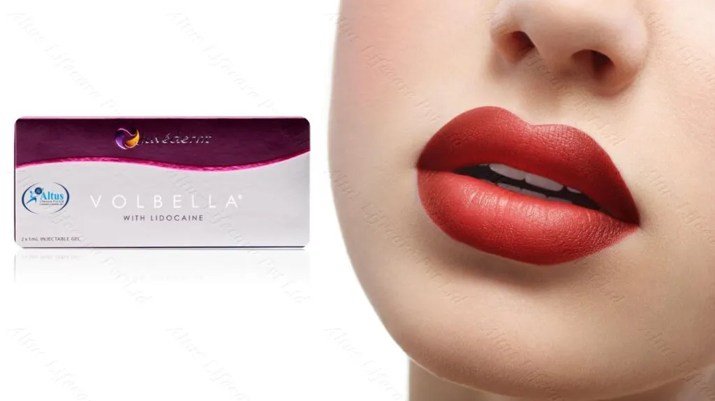 Volbella Filler's Stunning Results: Say Goodbye to Thin Lips Forever!