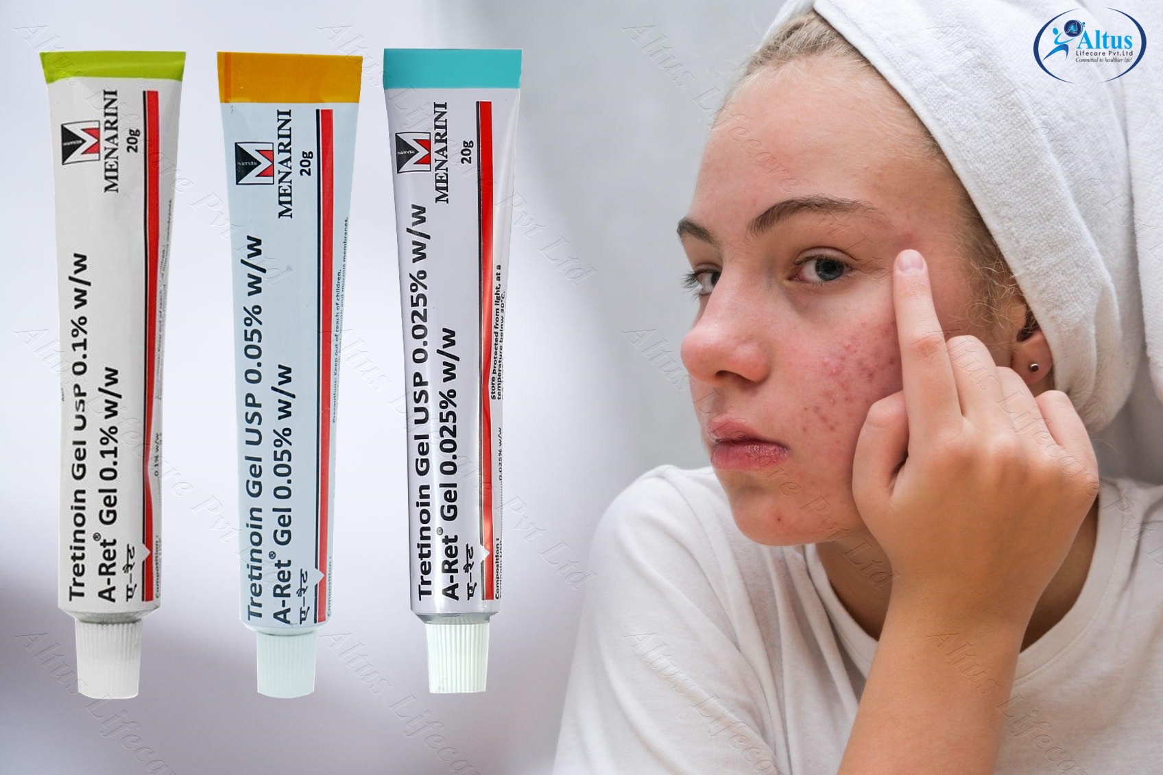 The #1 Acne Treatment They Don’t Want You to Know About – Shocking Results!