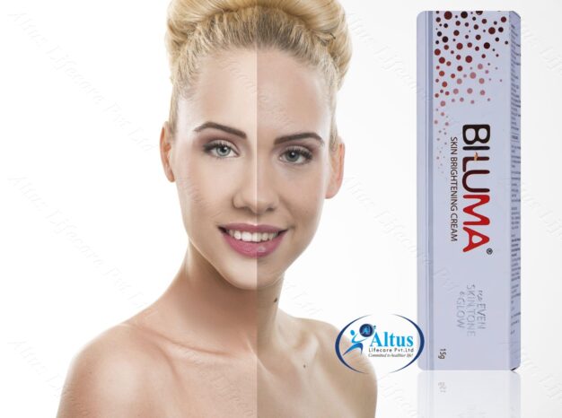 Erase Uneven Skin Texture with Biluma Cream – Your Secret to Radiant Skin!