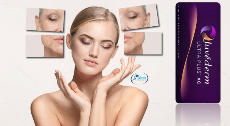 Juvederm Ultra XC Injection 3 1