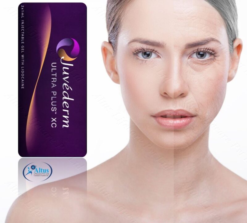 Juvederm Ultra XC Injection 6