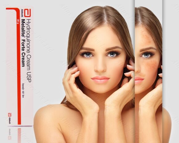 Hydroquinone 4 Cream: The Ultimate Skin Brightening Solution!