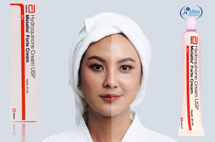Hydroquinone Cream Uses Top 10: From Dark Spots to Flawless Skin