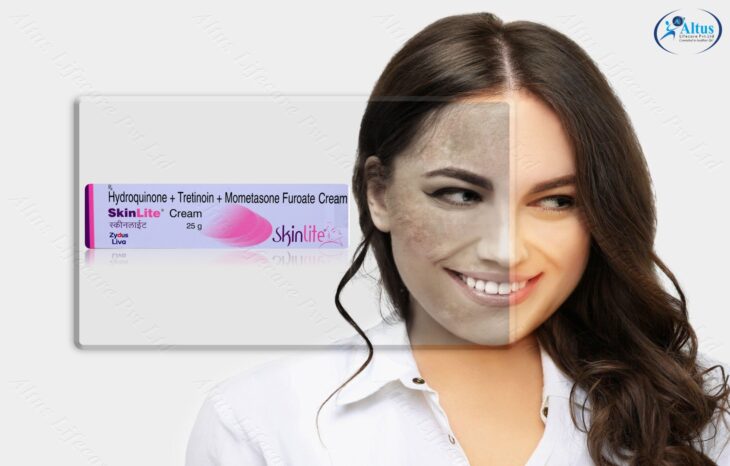 Hyperpigmentation of the Skin: Get Radiant Skin Fast!