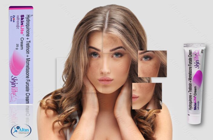 Hyperpigmentation of the Skin: Get Radiant Skin Fast!
