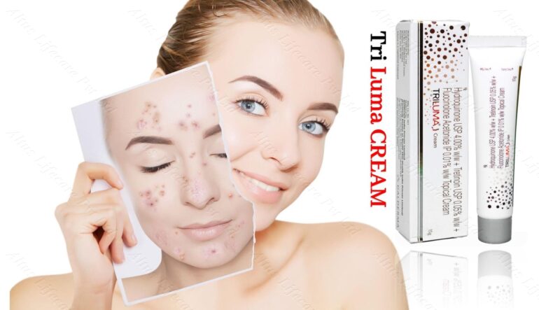 The #1 Acne Treatment They Don't Want You to Know About – Shocking Results!