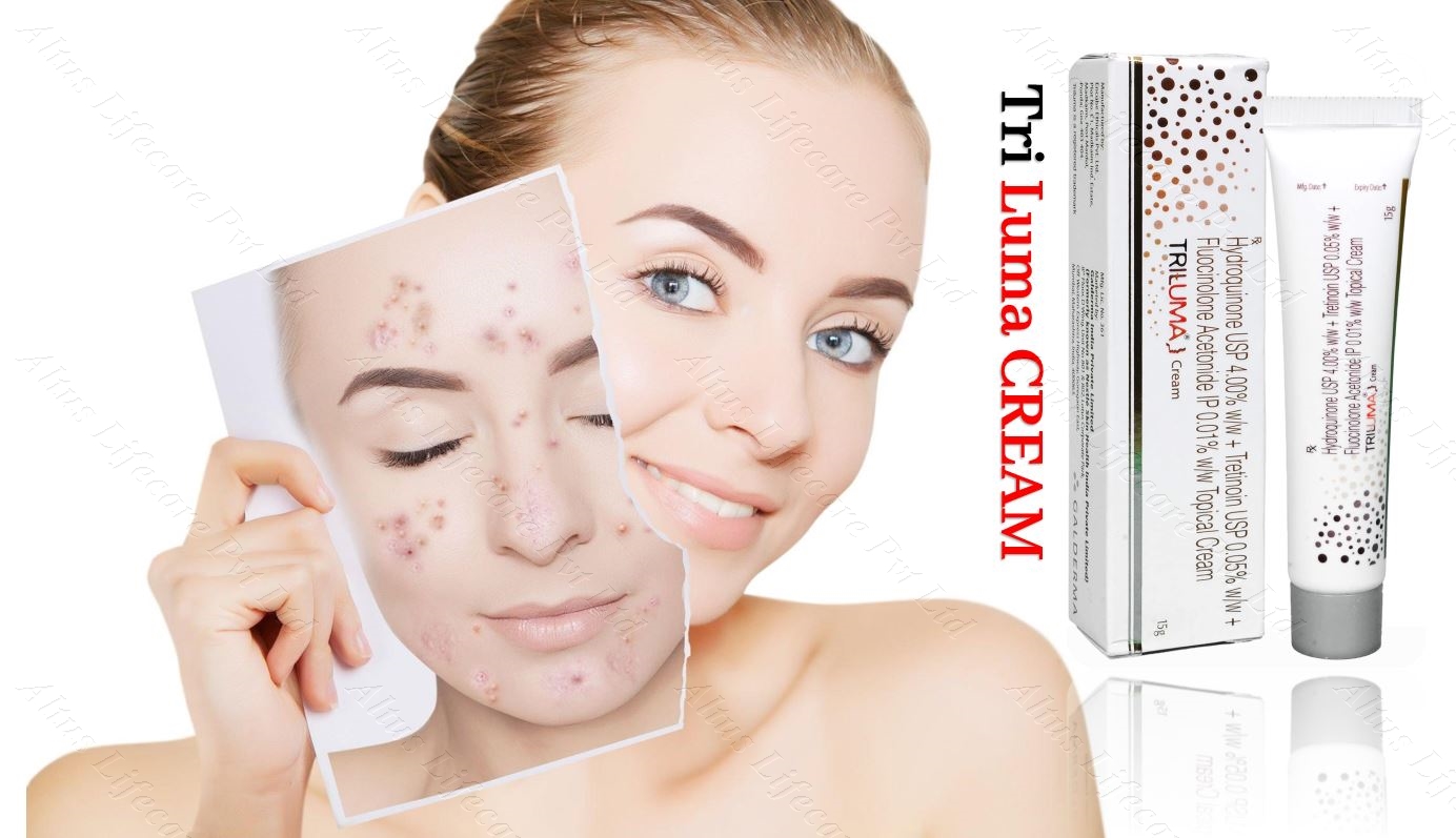 Erase Pimple Scars Like Magic! Discover the Ultimate Solution!