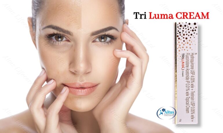 Tri Luma Before and After: Say Goodbye to Skin Issues Forever – Unbelievable!