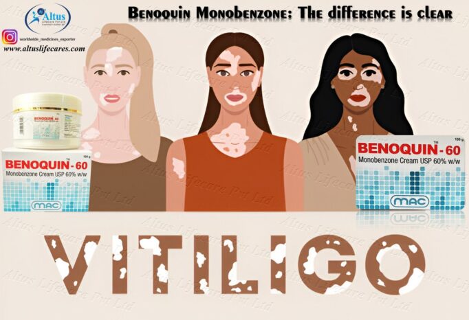 Benoquin 60 Cream