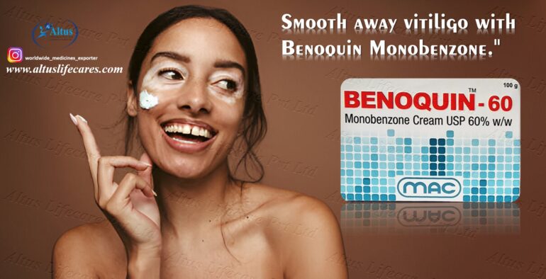 Benoquin 60 Cream