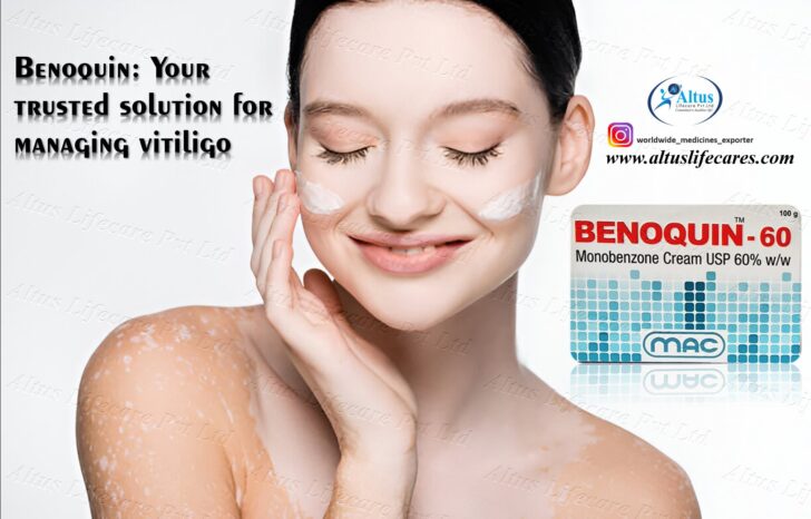 benoquin cream
