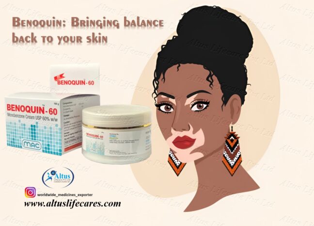 Benoquin 60 Cream