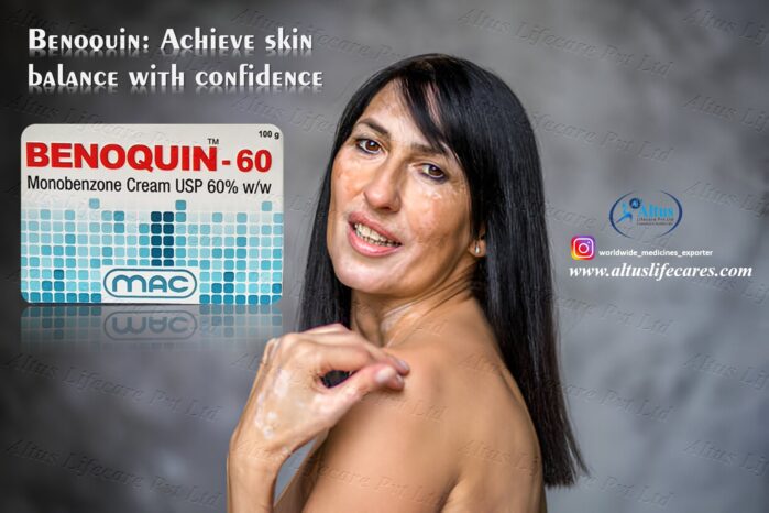 Benoquin 60 Cream