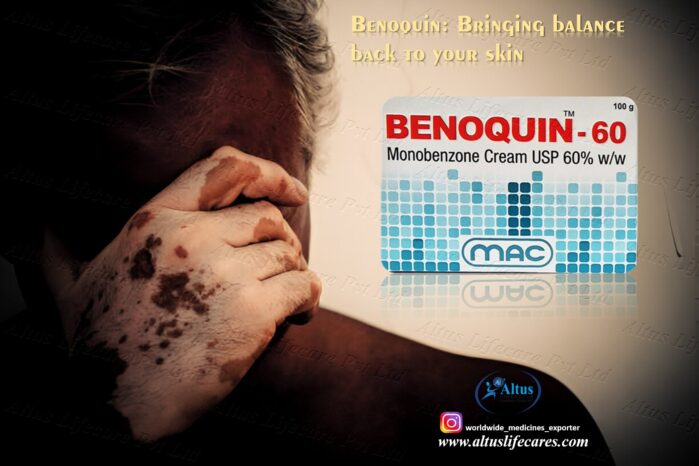 Benoquin Cream 60