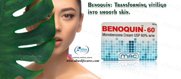 Benoquin Cream 60