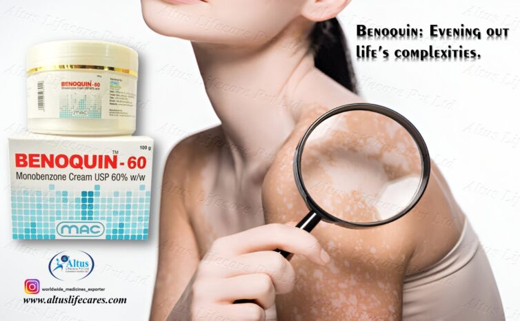 Benoquin 60% Cream for Vitiligo: A Deep Dive into Its Benefits and Risks