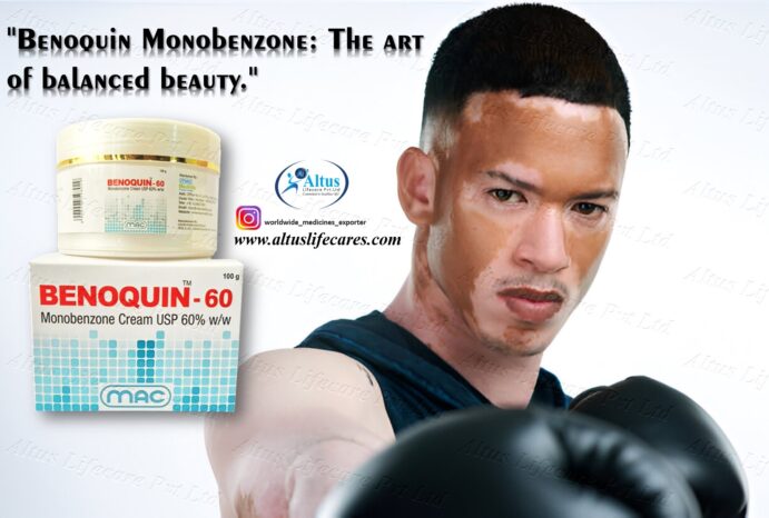 Benoquin 60% Cream for Vitiligo: A Deep Dive into Its Benefits and Risks
