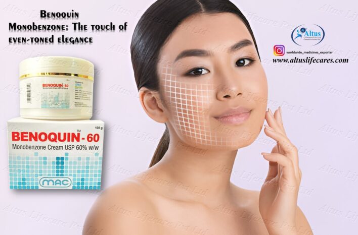 Benoquin 60% Cream for Vitiligo: A Deep Dive into Its Benefits and Risks